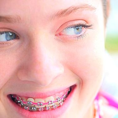 Clínica Dental Tarraco mujer con ortodoncia